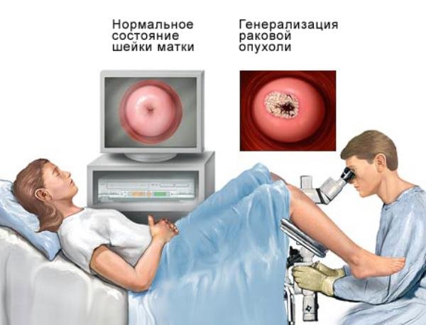 Современная кольпоскопия: быстро, безболезненно, информативно!